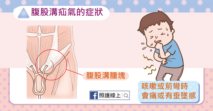 腹股溝疝氣的症狀-照護線上