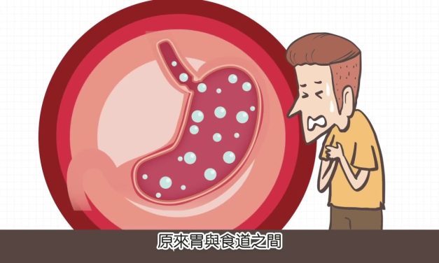 碰上胃食道逆流，該怎麼辦？（動畫）