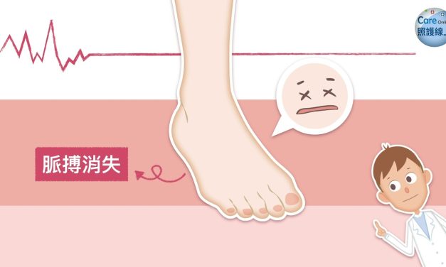 腳也會中風！注意急性肢體中風的５大警訊