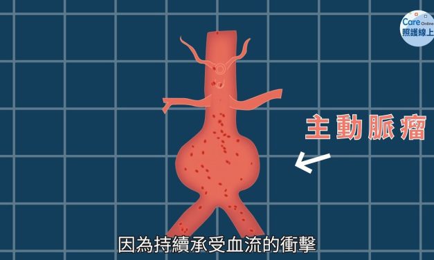致命的不定時炸彈 主動脈瘤