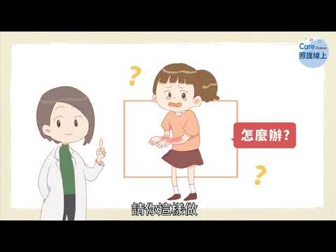 燙傷怎麼辦？一分鐘告訴你！