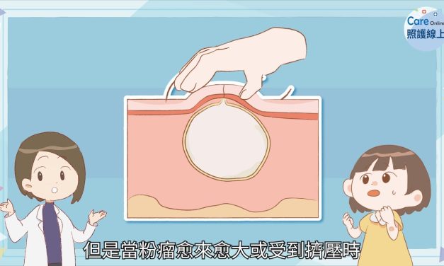 粉瘤千萬別亂擠，徹底根治看這裡！