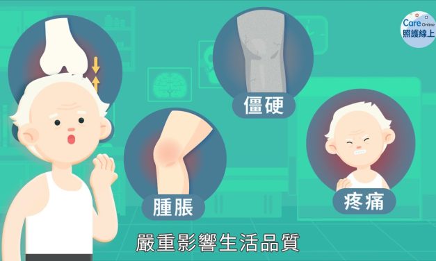 人工膝關節怎麼換？動畫解析看這裡