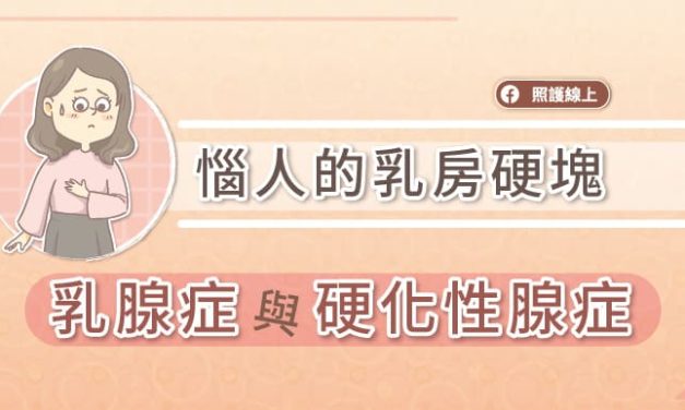 惱人的乳房硬塊 — 乳腺症與硬化性腺症
