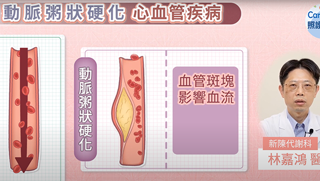 控制血糖、保護器官，糖尿病專家解說