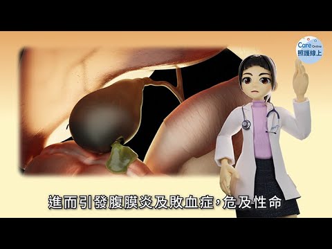 發燒、右上腹痛，膽囊炎怎麼辦？