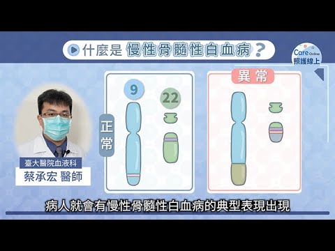 慢性骨髓性白血病，標靶治療有助長期存活