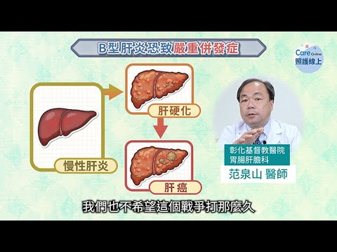 Ｂ型肝炎恐爆肝、易致癌，口服抗病毒藥物治療解析