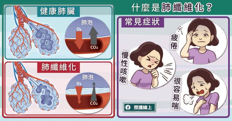 什麼是肺纖維化？