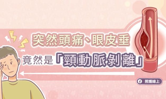 突然頭痛、眼皮垂，竟然是「頸動脈剝離」