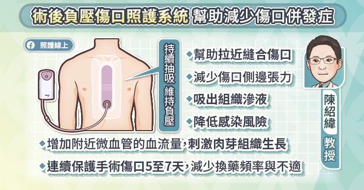 術後負壓傷口照護系統幫助減少燒口併發症