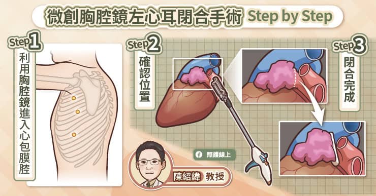 微創胸腔鏡左心耳夾閉合術 Step by Step