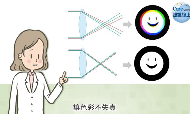 白內障找上門！精選5撇步教你挑選人工水晶體