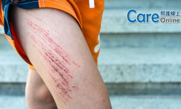 擦傷、割傷該怎麼辦？　急性傷口處理方法一次看！