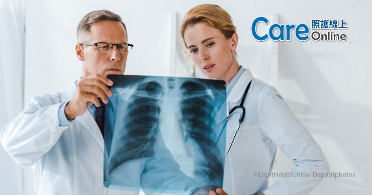 老煙槍罹癌怕切肺！　同步化放療＋免疫治療 有望提升治癒機會