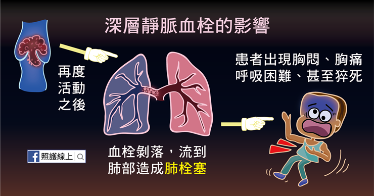 深層靜脈血栓可能導致肺栓塞