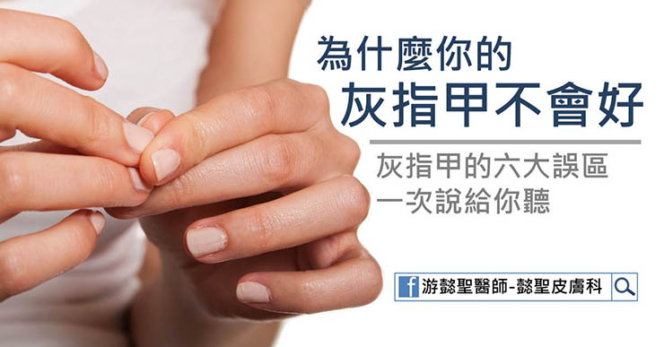 灰指甲不會好？６大誤區看清楚