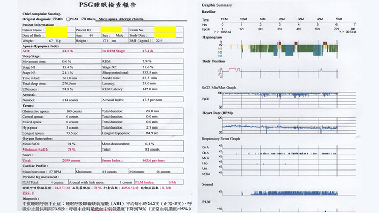 教你看睡眠檢查報告，初學者必看，一次就學得會