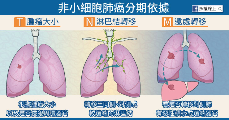 非小細胞肺癌分期依據