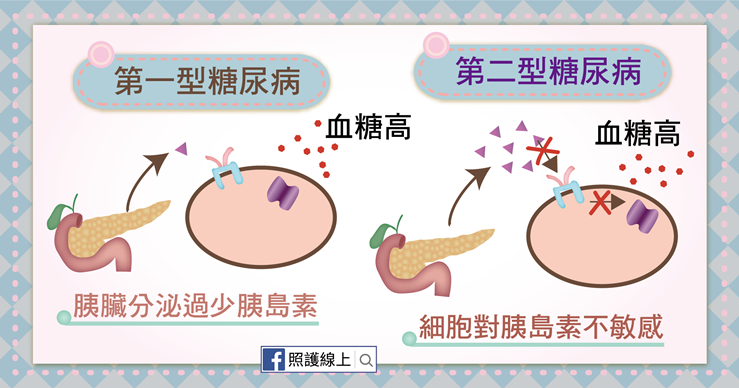 糖尿病能打胰島素嗎?(懶人包)-照護線上 第一型糖尿病與第二型糖尿病
