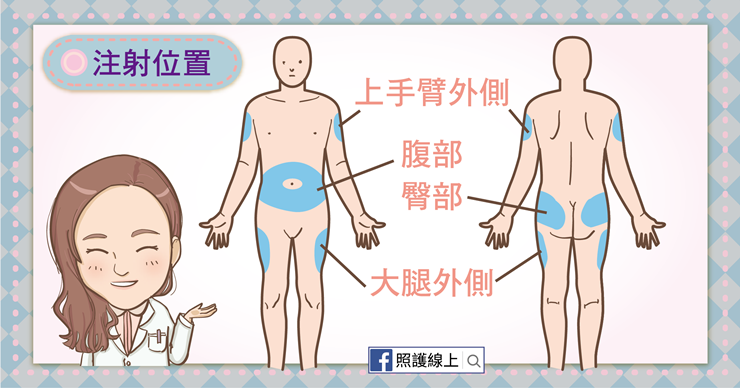 糖尿病能打胰島素嗎?(懶人包)-照護線上 注射胰島素的位置