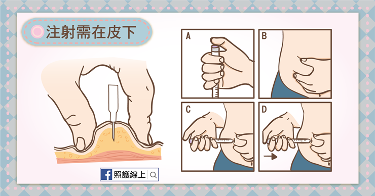 糖尿病能打胰島素嗎?(懶人包)-照護線上 將胰島素注射在皮下