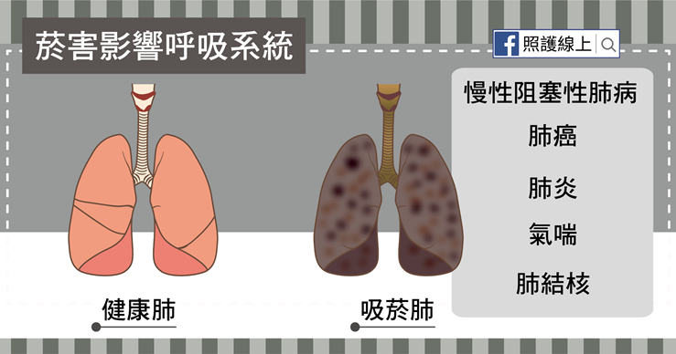 史上最強殺手 – 香菸（懶人包）