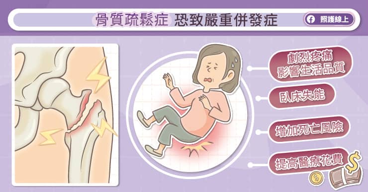 骨質疏鬆症恐致嚴重併發症