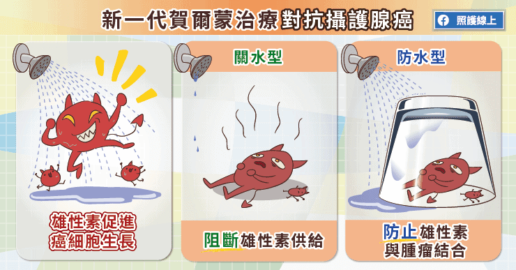 新一代賀爾蒙治療，對抗攝護腺癌