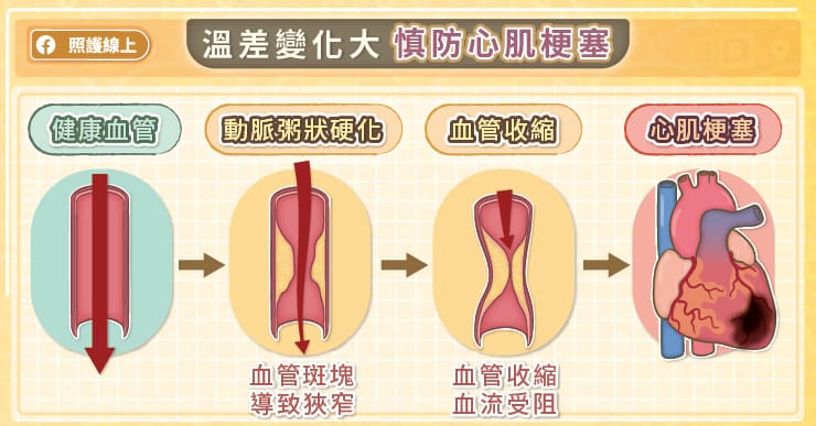 溫差變化大，慎防心肌梗塞