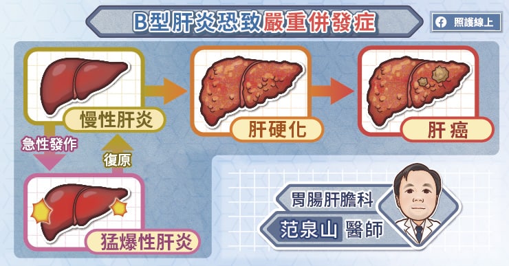 B型肝炎恐致嚴重併發症