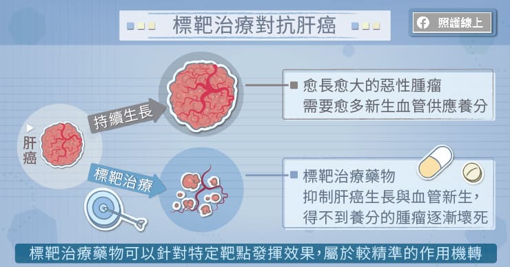 標靶治療對抗肝癌