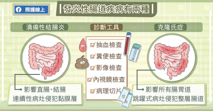 發炎性腸道疾病有兩種