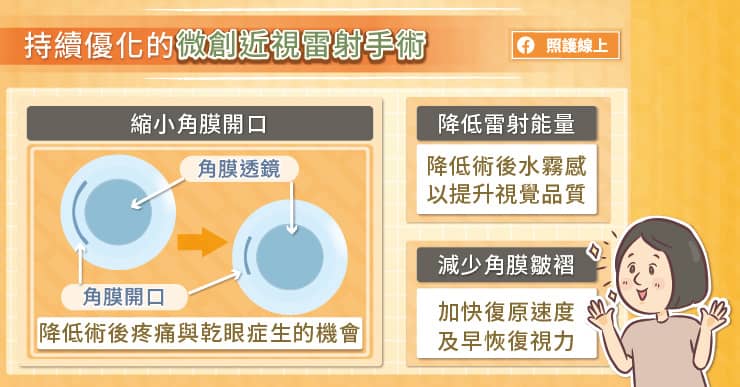 持續優化的微創近視雷射手術