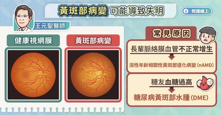黃斑部病變可能導致失明