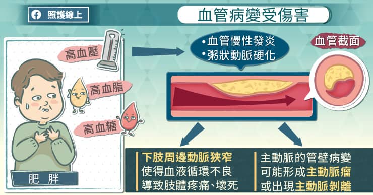 血管病變受傷害