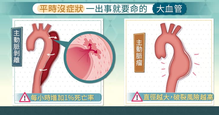 平時沒症狀，一出事就要命的大動脈