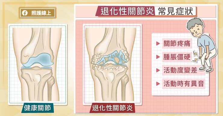 退化性膝關節炎常見症狀
