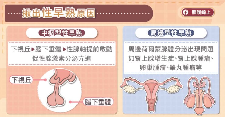 揪出性早熟的原因