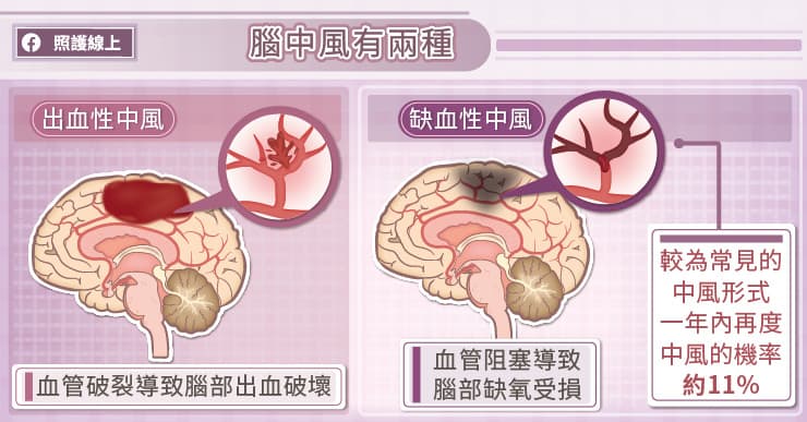 腦中風分為出血性及缺血性兩類型