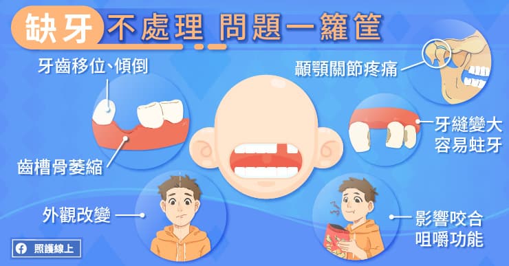 缺牙不處理問題一籮筐