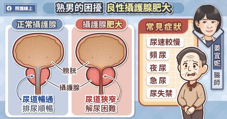 熟男的困擾良性攝護腺肥大