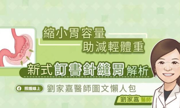 縮小胃容量助減輕體重，新式訂書針縫胃解析，劉家嘉醫師圖文懶人包