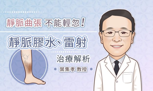 靜脈曲張不能輕忽！靜脈膠水、雷射治療解析