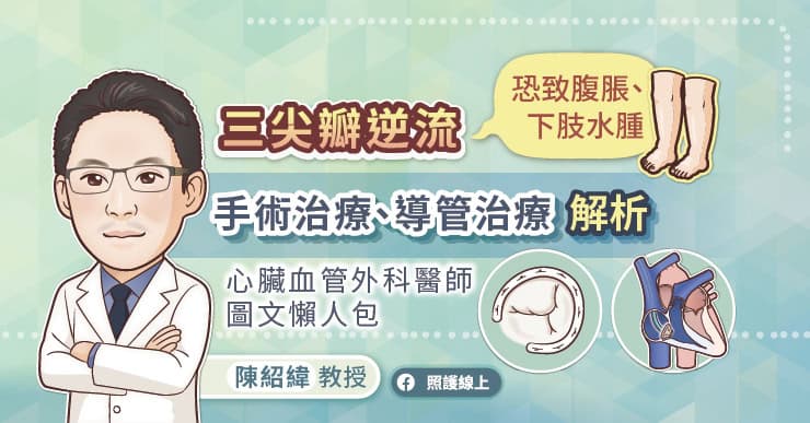 三尖瓣逆流恐致腹脹、下肢水腫，手術治療、導管治療解析，心臟血管外科醫師圖文懶人包