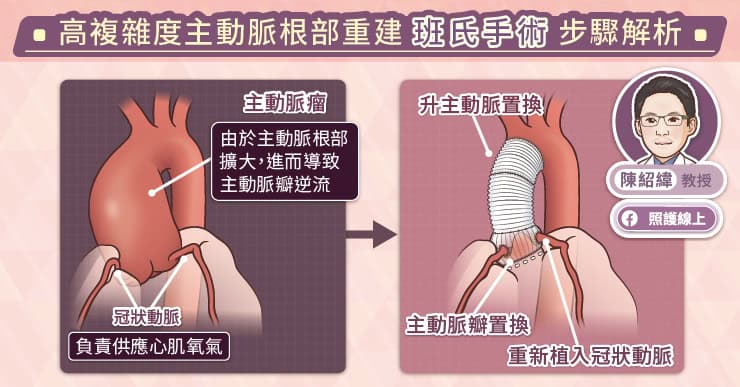 高複雜度主動脈根部重建-「班氏手術」步驟解析