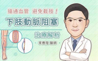 搶通血管,避免截肢!下肢動脈阻塞治療解析