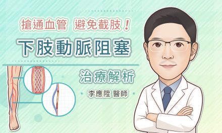 搶通血管，避免截肢！下肢動脈阻塞治療解析