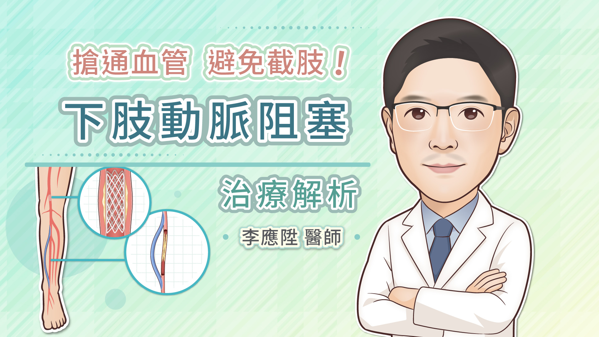 搶通血管，避免截肢！下肢動脈阻塞治療解析 | 照護線上-深受信賴的醫療媒體