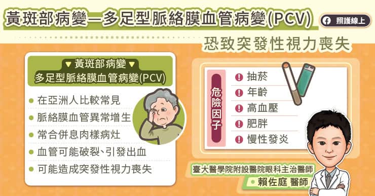 多足型脈絡膜血管病變視力喪失